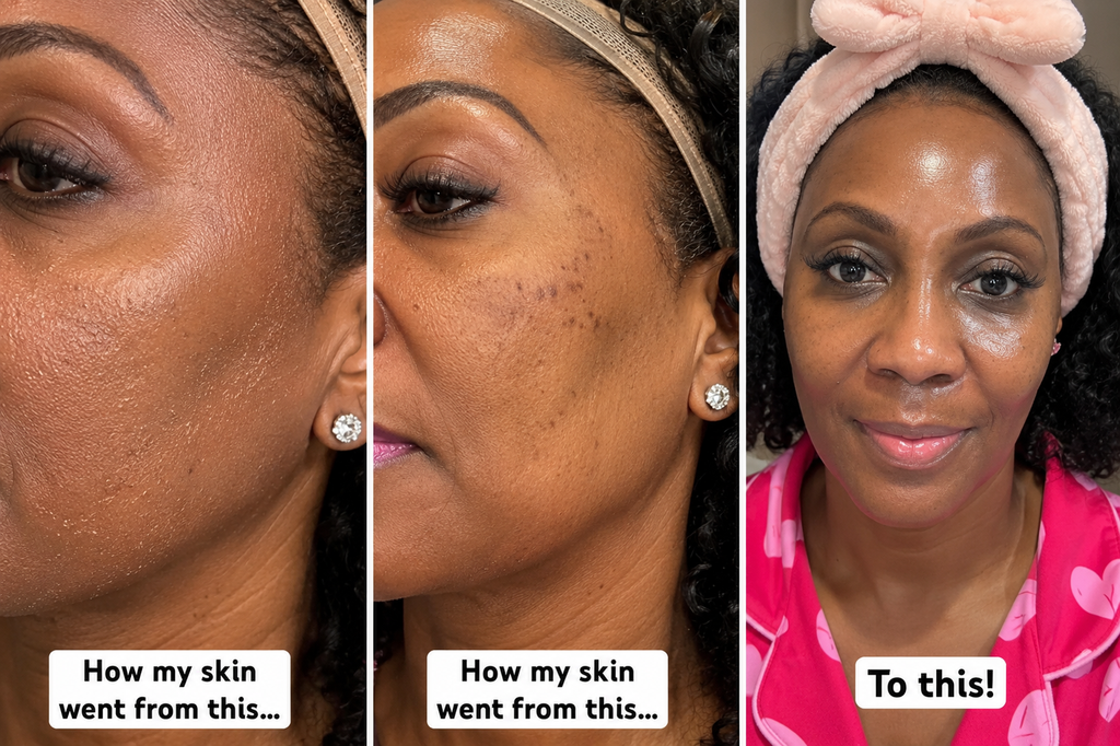 Turmeric Face Butter Treatment