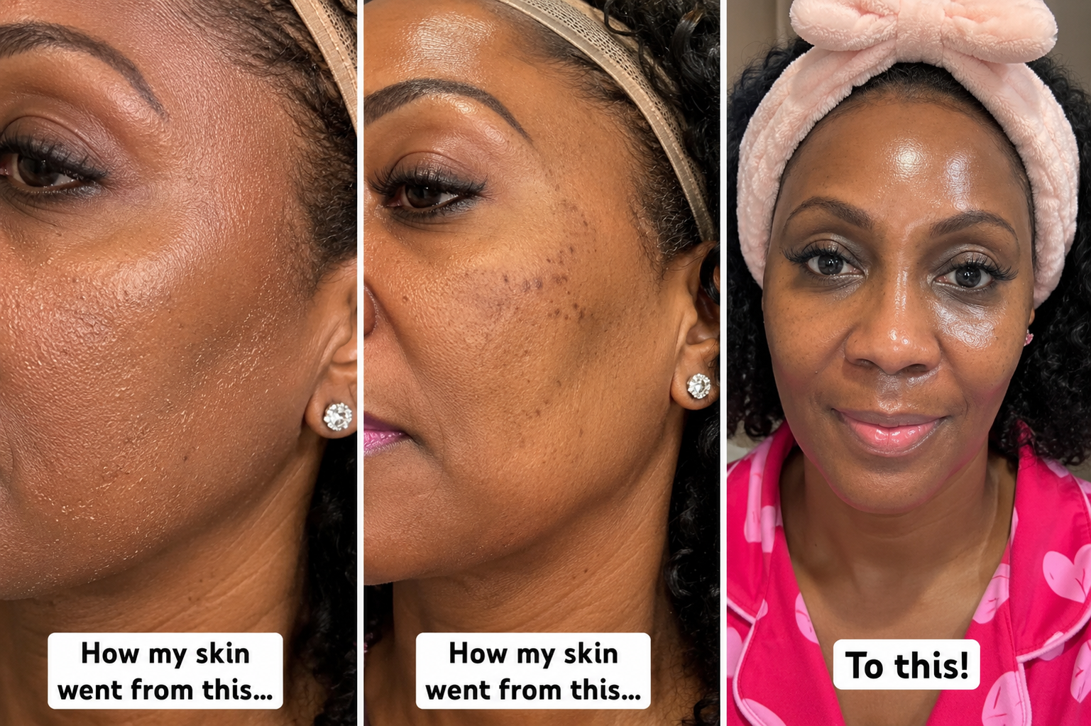 Turmeric Face Butter Treatment